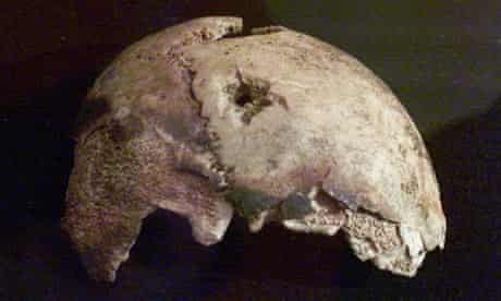 hitler's skull