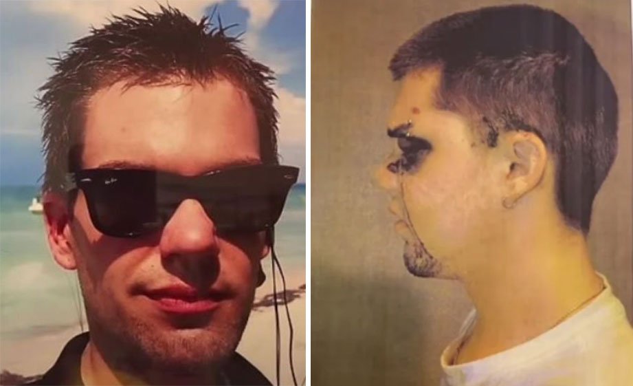 Ryan Waller before and after the attack